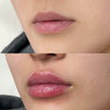 Lipfillers met vitamine E - natuurlijk serum - snelle werking & langdurig