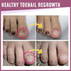Teennagels Correctie Pleisters