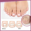 Teennagels Correctie Pleisters
