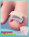 Teennagels Correctie Pleisters