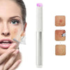 Acne Lichttherapie Pen - Krachtige LED Behandeling