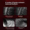 Massaggiatore per il cuoio capelluto per la crescita dei capelli – Rinforza i tuoi capelli e rilassa il tuo cuoio capelluto