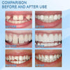Kit di riparazione dentale fai-da-te