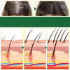 Aplio Care | Rinforza le radici dei capelli e previeni la caduta dei capelli